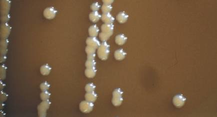 写真）Lactobacillus属乳酸菌が寒天培地上に作ったコロニー