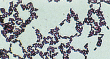 写真） 細胞染色後の顕微鏡観察像